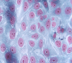 細(xì)胞侵襲、轉(zhuǎn)染